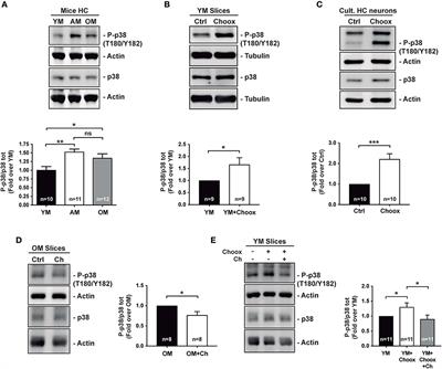 Aging Increases Hippocampal DUSP2 by a Membrane Cholesterol Loss-Mediated RTK/p38MAPK Activation Mechanism